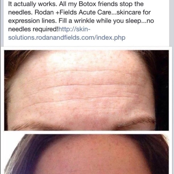 Rodan and Fields