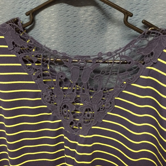 Navy and green striped tunic - Picture 3 of 3