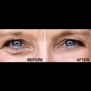 Zija's GenM Under Eye Serum