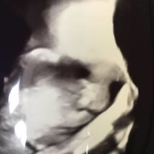 Meet your Posher, Lorrie