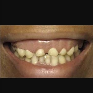 Meet your Posher, Carla