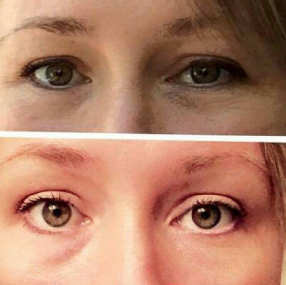 Lip & Eye Gel - Picture 2 of 3