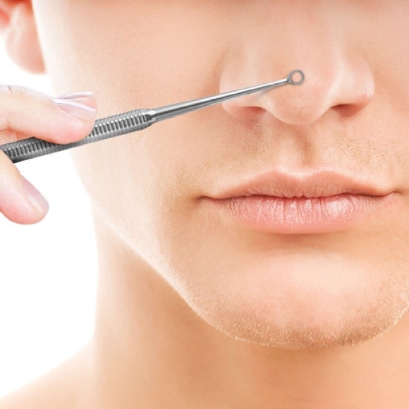 Pimple and blackhead remover tool