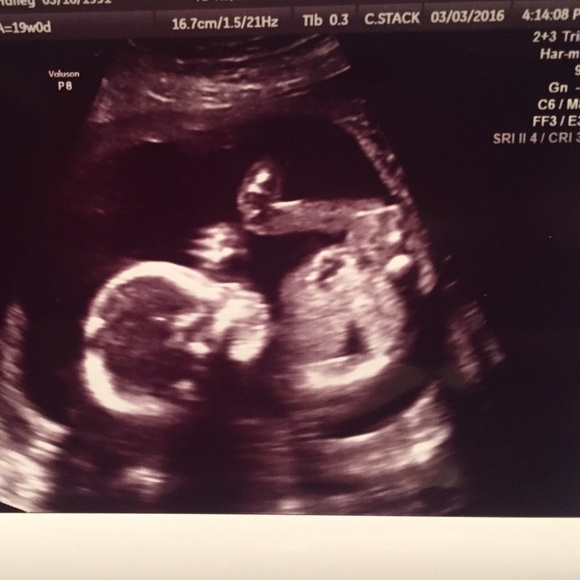 πͺβ€οΈSALE!!!β€οΈπͺ - Picture 3 of 3