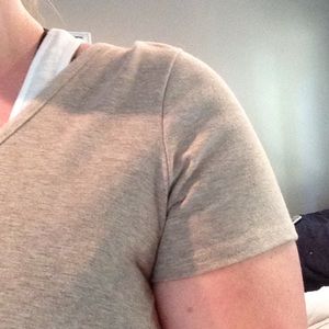 EXTRA PHOTO OF SLEEVE OF DRESS