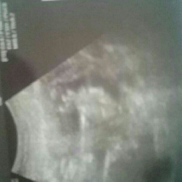 Meet your Posher, Dixie - Picture 1 of 1