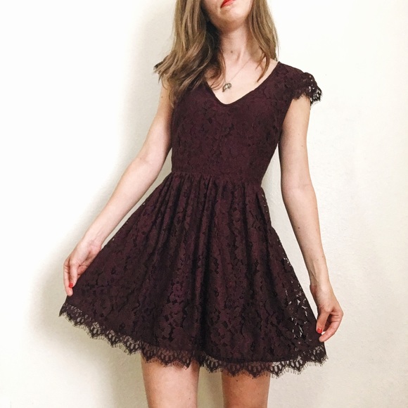 XS Kimchi Blue, Urban Outfitters Lace Dress