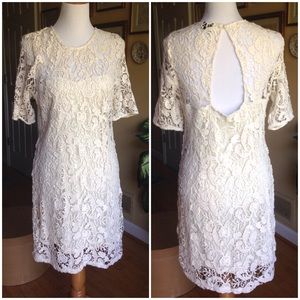 Urban Outfitters Sparkle & Fade Lace Dress!