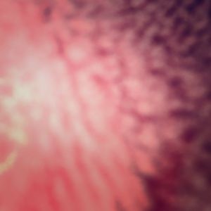 comments or concerns