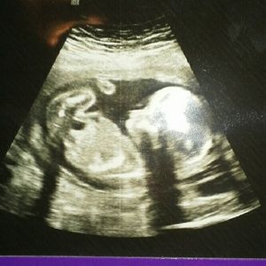 Meet your Posher, Francisco