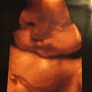 Meet your Posher, Ana