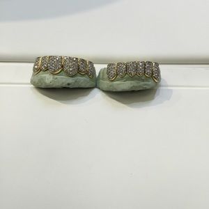 Gold and diamond teeth