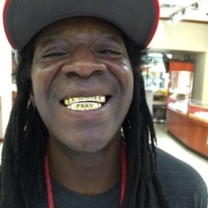 Gold and diamond teeth
