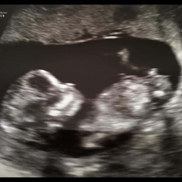 Hi there! I'm Kaitlin! - Picture 4 of 4