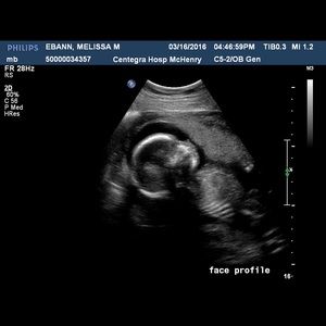 Meet your Posher, Spencer