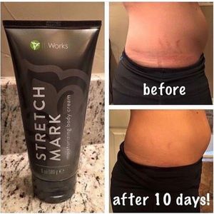 Stretch mark cream