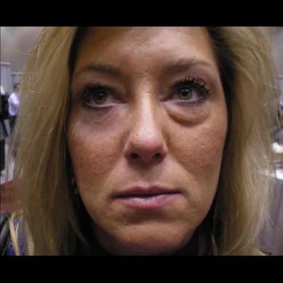 Instantly Ageless