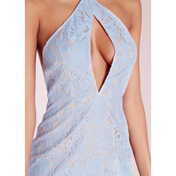 NWT Missguided Blue Lace Cut Out Dress - Picture 3 of 5