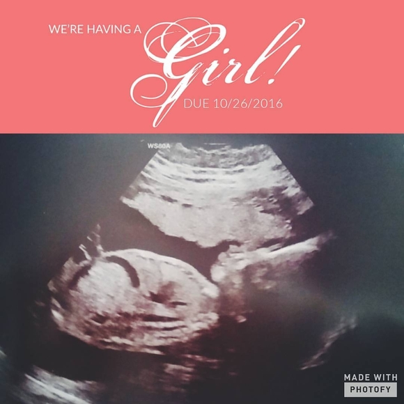 Meet your Posher, Manette - Picture 1 of 1