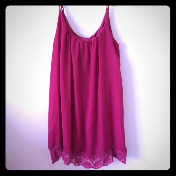 Tobi Dresses & Skirts - Tobi Dress!