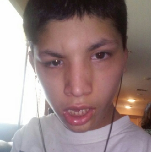 Cerebral palsey awareness