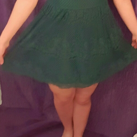 Forever 21 Lace Open-back Dress - Picture 2 of 4