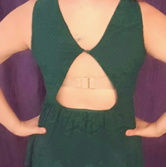 Forever 21 Lace Open-back Dress - Picture 4 of 4