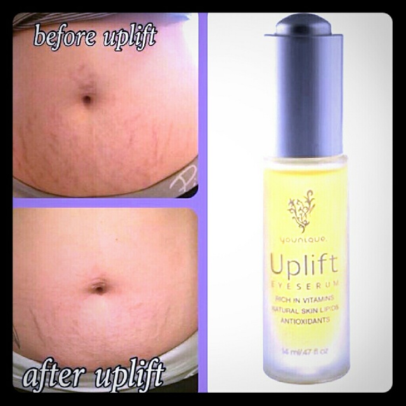 Uplift