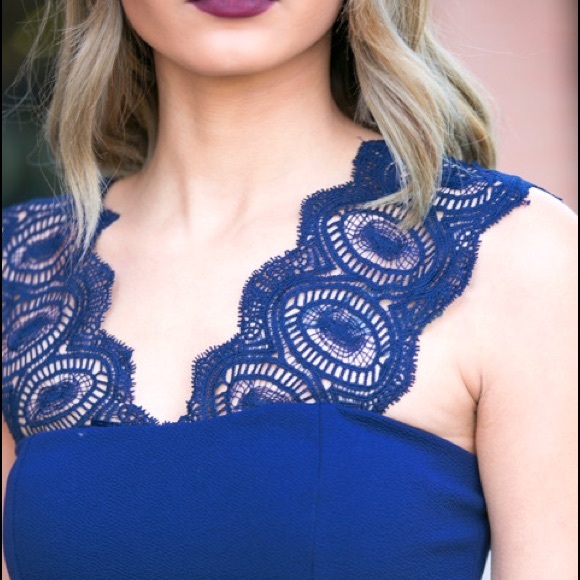 Lace detailed part dress - Picture 3 of 4