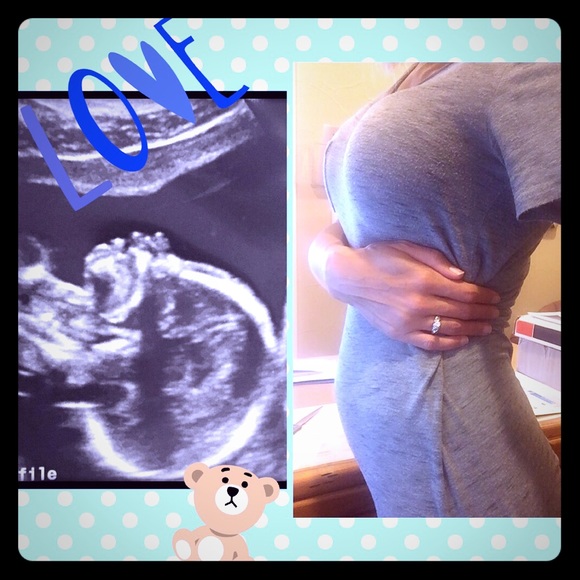 IT'S A 💙BOY💙