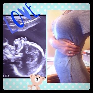 IT'S A 💙BOY💙