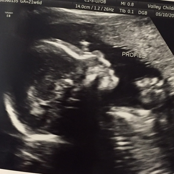 Meet your Posher, Riley