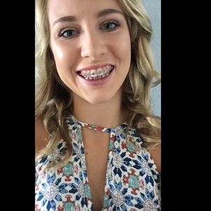 Meet your Posher, Skylar