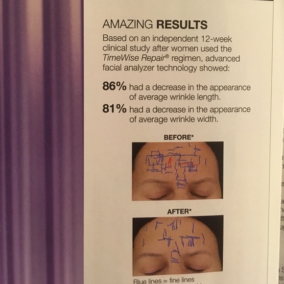 TimeWise Repair set - Picture 2 of 4