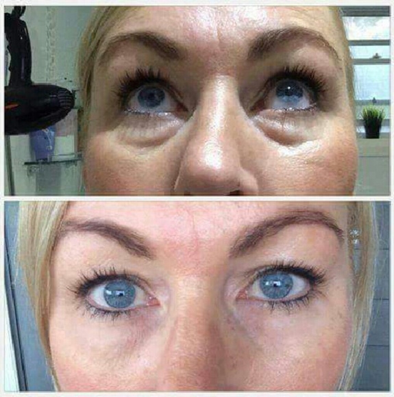 Skin brightening serum!! Brand NEW!! JUST RELEASED - Picture 4 of 4