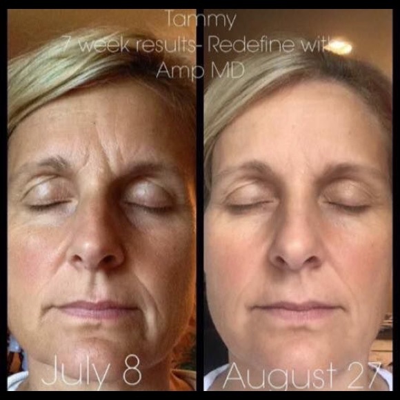 RF Redefine Bundle... For limited time only! - Picture 3 of 4