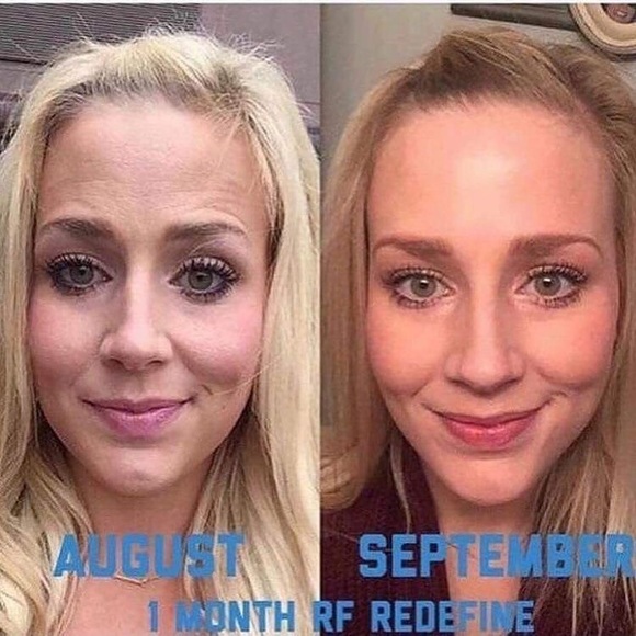 RF Redefine Bundle... For limited time only! - Picture 4 of 4