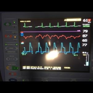 Meet your Posher, Joy anne