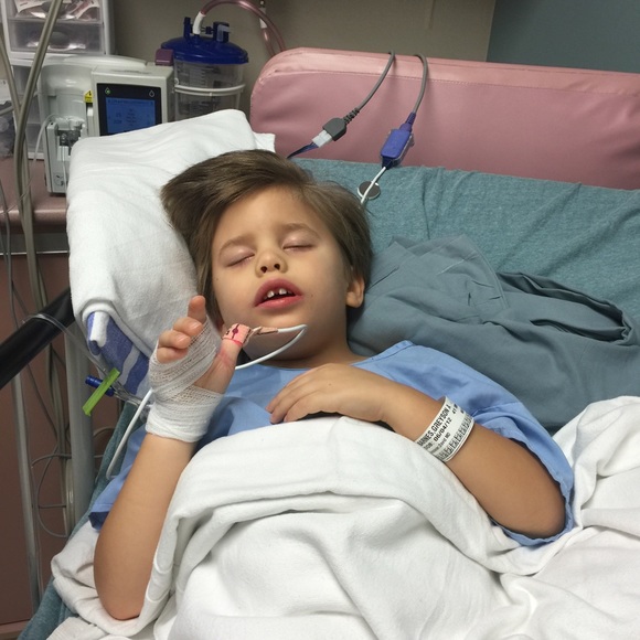 CASTS R OFF!!! #TeamGreyBoo #StopCMV #cpawareness - Picture 3 of 4