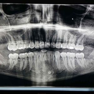 Meet your Posher, Ro