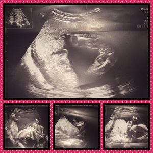 Meet your Posher, Sydney