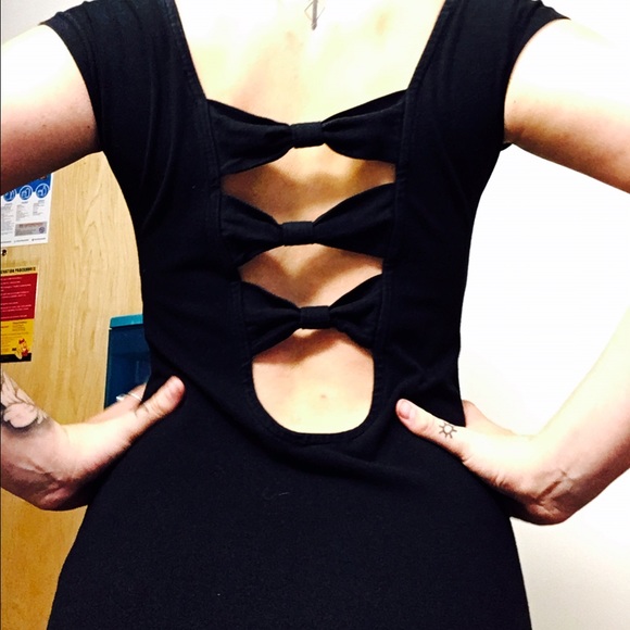 LBD