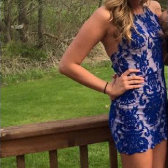 Lace dress