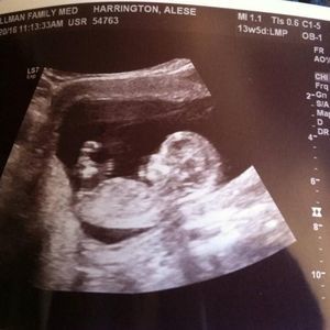 Meet your Posher, Alese