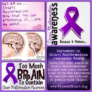 Meet your Posher, Kellee