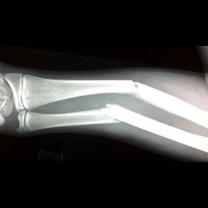 Meet your Posher, Chad