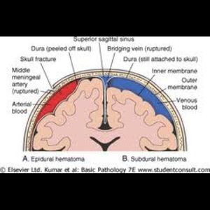Meet your Posher, Asma