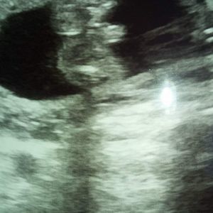 Meet your Posher, Brandii