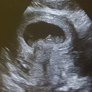 Meet your Posher, Raven