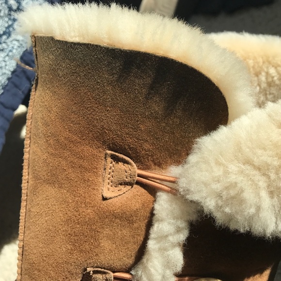 how to fix ugg boots buttons how to fix ugg boots buttons